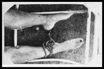 Folterspuren: Eines der Fotos, die von der CIDH übergeben wurden