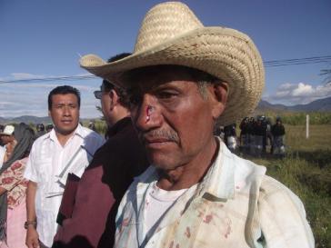 Auseinandersetzung um Wasser für Mine in Oaxaca: Ein Anwohner von Magdalena Ocotlán wurde verletzt